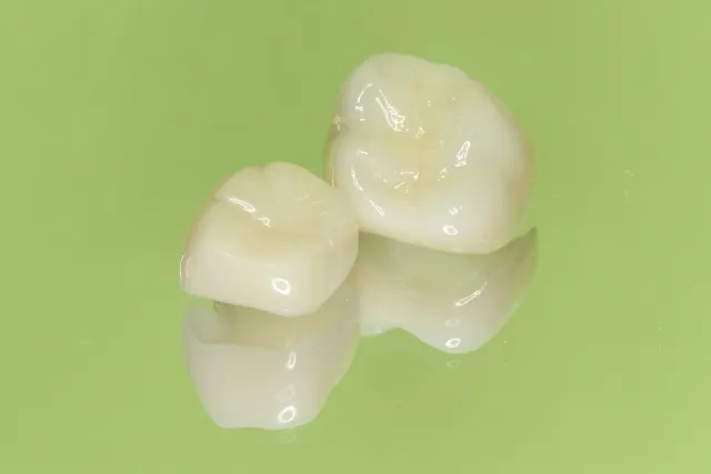 質の高い補てつ物