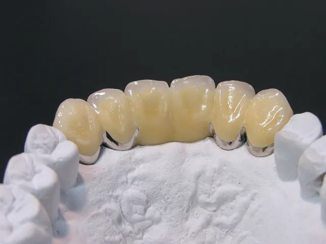 当院の審美治療の特徴